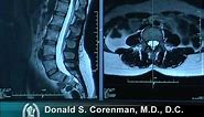 How to Read a MRI of the Normal Lumbar Spine | Lower-Back | Vail Spine Specialist