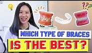 Types of Braces COMPARED & EXPLAINED! | #BraceYourself!🦷