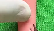 Proximal nail fold nevus excision _part 1_ #6624 | Beaute