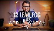 Apple watch ECG: 12 leads