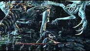 Bloodborne Boss Guide: How to beat Amygdala