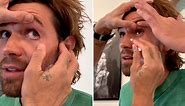 Riverdale star KJ Apa breaks down in tears after metal shard ‘punctures’ his left eye