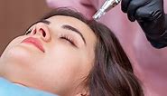 Hairline Microblading: Benefits, Downsides, And How It Works