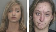 These Terrifying Photos Show How Heroin, Cocaine and Oxycodone Change Your Appearance Over Time