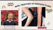 A novel treatment for Keratosis pilaris