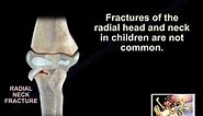 Radial Head & Neck Fractures In Children - Everything You Need To Know - Dr. Nabil Ebraheim