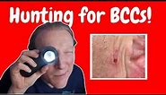 BCC: Basal Cell Carcinoma Skin Cancer: What You NEED to KNOW