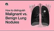Distinguish Malignant vs. Benign Lung Nodules