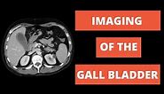 How to Image the Gallbladder - Ultrasound, CT, MRI, HIDA Basics