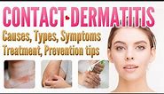 Contact Dermatitis Causes, Types, Symptoms, Treatment, Prevention | contact eczema