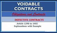 Voidable Contracts. Article 1390-1402. Defective Contracts. Obligations and Contracts.