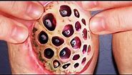What is Trypophobia? What Causes a Fear of Holes?