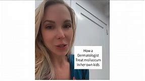 Molluscum Contagiosum; treatment options