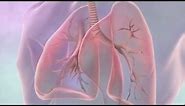 Treatments for lung cancer | Cancer Research UK