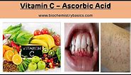 Vitamin C - Ascorbic Acid || Vitamin C Biochemistry || Scurvy