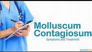 Molluscum Contagiosum ¦ Treatment and Symptoms