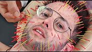 Zach Tries 1000 Needle Acupuncture