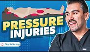 Pressure Injuries (Ulcers) Nursing | Patho, Causes, 6 Stages, Braden Scale