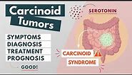 Carcinoid Tumor | Visual Explanation | Symptoms, diagnosis, treatment, prognosis