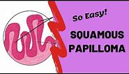Squamous Papilloma | Oral Pathology Lectures