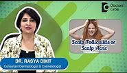 ACNE OR PIMPLES ON SCALP | Scalp Folliculitis - Causes & Treatment- Dr.Rasya Dixit | Doctors' Circle
