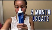 2 month Update Review of Metronidazole Cream for my Perioral Dermatitis and Acne