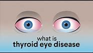 What is Thyroid Eye Disease (TED)?