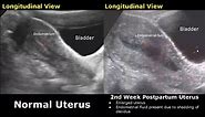 Gynecological & Obstetric Ultrasound Normal Vs Abnormal Scan | Uterus, Ovary, Cervix, Pregnancy USG
