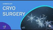 Cryo Surgery Procedure (Freezing)