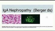 IgA Nephropathy ( Berger disease)
