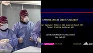 Transradial Carotid Artery Stenting