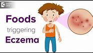 Foods triggering eczema flare up | Help your child avoid the itch! - Dr. Udhay Sidhu