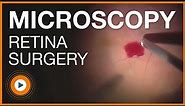 Ophthalmic Microsurgery Posterior Retina