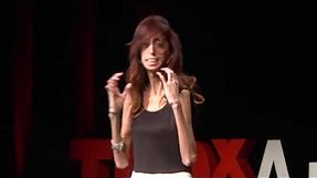 How do you define yourself? | Lizzie Velasquez | TEDxAustinWomen