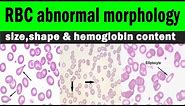 Red blood cells | RBC abnormal morphology | size,shape & hemoglobin content | Hematology
