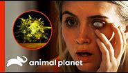 Contact Lens Parasite Almost Blinds Woman | Monsters Inside Me