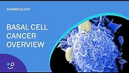 Basal Cell Cancer Overview [Dermatology]