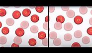 Sickle Cell: Natural Selection in Humans | HHMI BioInteractive Video