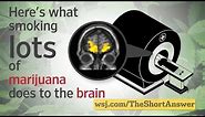 Marijuana: Heavy Users Risk Changes to Brain