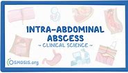 Intra-abdominal abscess: Clinical sciences - Osmosis Video Library