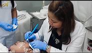 Warts removal (Cautery)