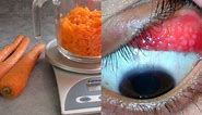 If You Eat 2 Carrots Per Day For A Month, This Is What Happens To Your Eyes