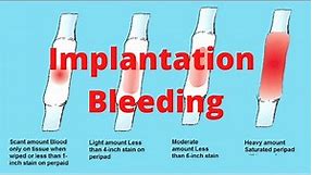 Implantation Bleeding || Know.