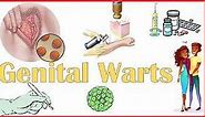 Genital Warts - Causes, Risk Factors, Signs & Symptoms, Treatment