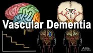 Vascular Dementia Pathology, Animation