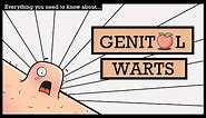 GENITAL WARTS, Causes, Signs and Symptoms, Diagnosis and Treatment.