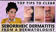 Top Tips to Clear Seborrheic Dermatitis | Dermatologist Deep Dive