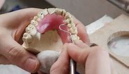 Study finds gum infections and tooth loss can shrink your brain - Interesting Engineering