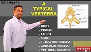 Typical Vertebra | Body | Pedicle | Transverse process | Lamina | Vertebral foramen | spine |anatomy
