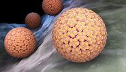 HPV (Human Papillomavirus): Symptoms & Treatment